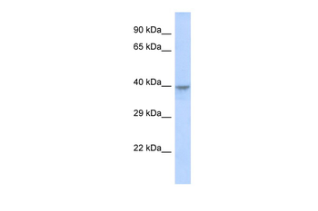 DACH2 Rabbit Polyclonal Antibody