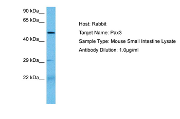 PAX3 Rabbit Polyclonal Antibody