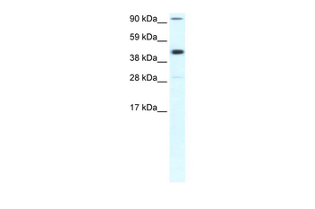 POLR2B Rabbit Polyclonal Antibody
