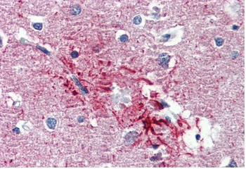 HMGN1 Rabbit Polyclonal Antibody