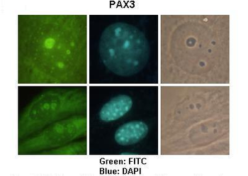 PAX3 Rabbit Polyclonal Antibody