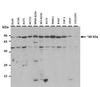 PIAS3 Rabbit Polyclonal Antibody