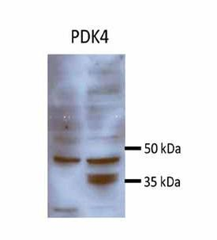PDK4 Rabbit Polyclonal Antibody