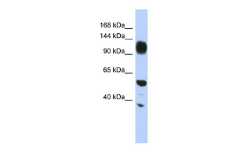 WDHD1 Rabbit Polyclonal Antibody