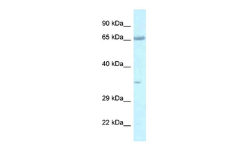 Lzts1 Rabbit Polyclonal Antibody