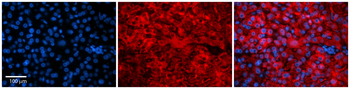 Snf8 Rabbit Polyclonal Antibody
