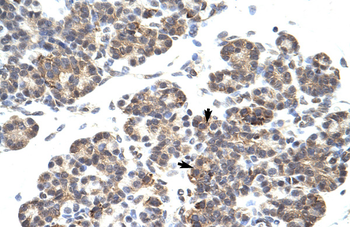 HES6 Rabbit Polyclonal Antibody