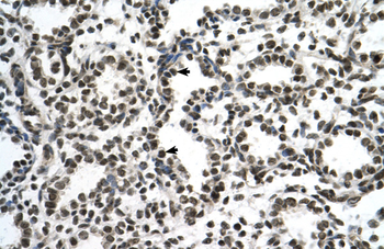 ZNF706 Rabbit Polyclonal Antibody