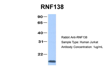 RNF138 Rabbit Polyclonal Antibody