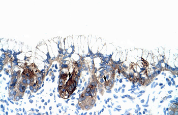 PMF1 Rabbit Polyclonal Antibody
