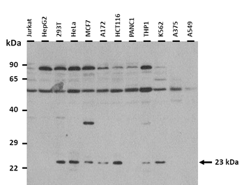 RAB18 Rabbit Polyclonal Antibody