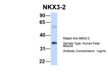 NKX3-2 Rabbit Polyclonal Antibody