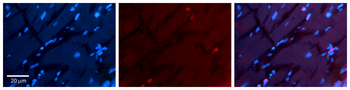 RING1 Rabbit Polyclonal Antibody
