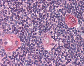 BCL11B Rabbit Polyclonal Antibody