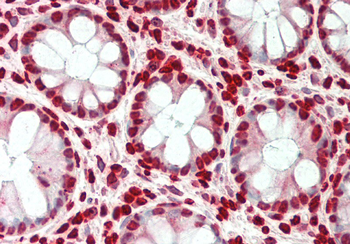 SMARCE1 Rabbit Polyclonal Antibody