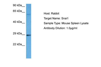 SNAI1 Rabbit Polyclonal Antibody