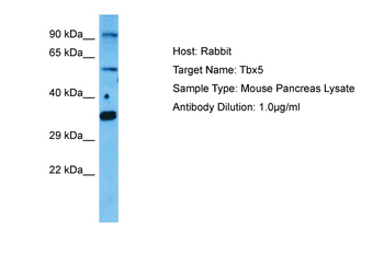 TBX5 Rabbit Polyclonal Antibody