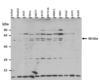 TBX5 Rabbit Polyclonal Antibody