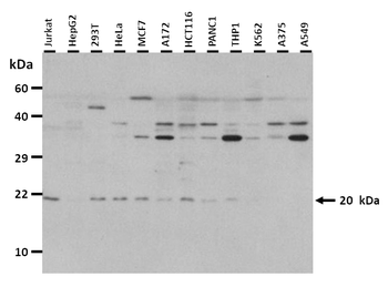 TCF21 Rabbit Polyclonal Antibody