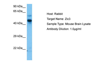 ZIC3 Rabbit Polyclonal Antibody