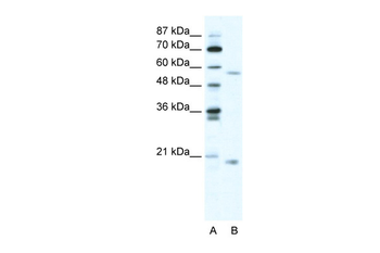 ZNF18 Rabbit Polyclonal Antibody