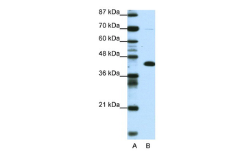 ZBTB25 Rabbit Polyclonal Antibody