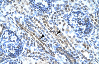 ANKRD11 Rabbit Polyclonal Antibody