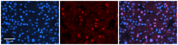 ZNF236 Rabbit Polyclonal Antibody