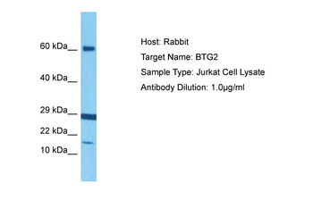 BTG2 Rabbit Polyclonal Antibody