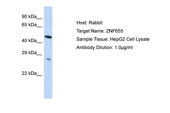 ZNF655 Rabbit Polyclonal Antibody