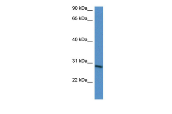 BARX2 Rabbit Polyclonal Antibody