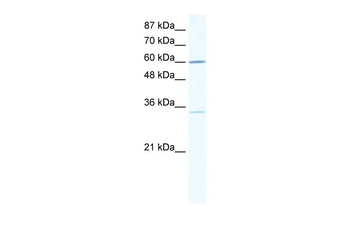ZNF668 Rabbit Polyclonal Antibody