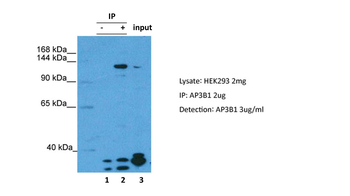 Ap3b1 Rabbit Polyclonal Antibody