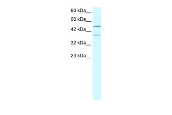 USP3 Rabbit Polyclonal Antibody