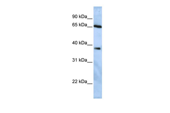 USP3 Rabbit Polyclonal Antibody