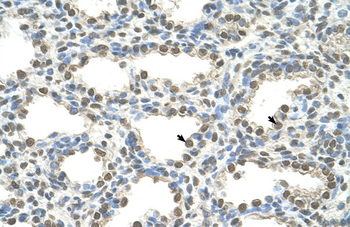 FOXQ1 Rabbit Polyclonal Antibody