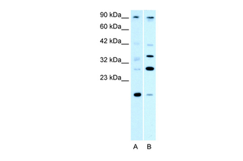 PARP11 Rabbit Polyclonal Antibody