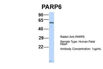 PARP6 Rabbit Polyclonal Antibody