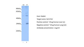 SLC17A2 Rabbit Polyclonal Antibody