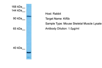 KIF5B Rabbit Polyclonal Antibody