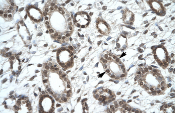 KIF25 Rabbit Polyclonal Antibody
