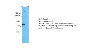 KIF15 Rabbit Polyclonal Antibody