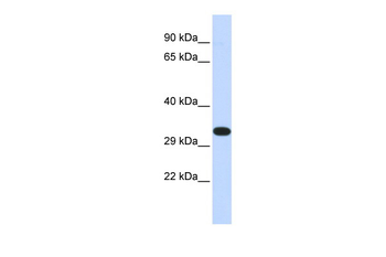 KIF25 Rabbit Polyclonal Antibody