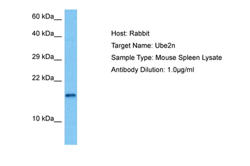 UBE2N Rabbit Polyclonal Antibody