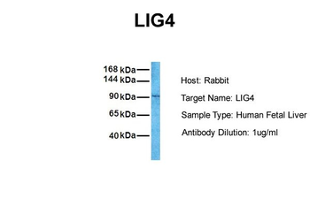 LIG4 Rabbit Polyclonal Antibody
