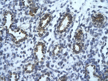 USE1 Rabbit Polyclonal Antibody