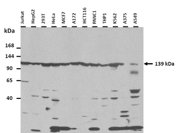 TIMELESS Rabbit Polyclonal Antibody