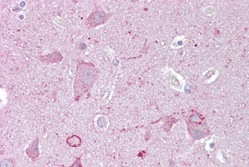 EGR3 Rabbit Polyclonal Antibody