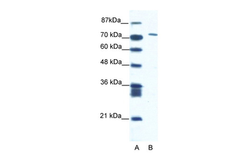 CXORF6 Rabbit Polyclonal Antibody