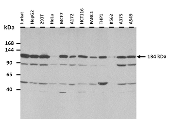 AFF3 Rabbit Polyclonal Antibody
